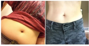 Before and After Flab May